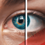 tired eye
