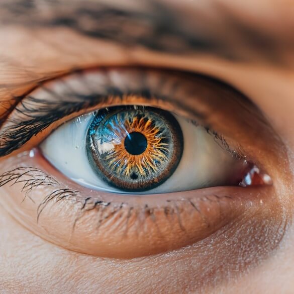LASIK EYE SURGERY
