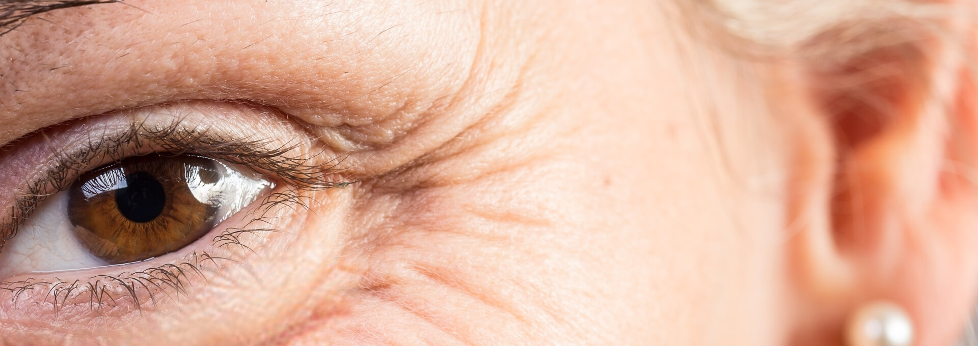 dry-eyetreatment