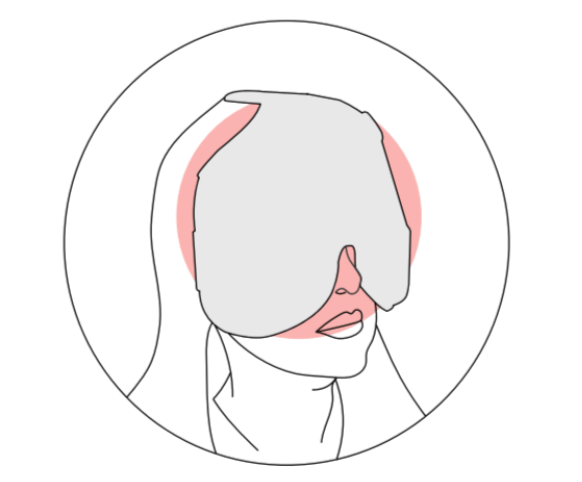 Blepharo Microexfoliation (Bleph-Ex) - Espansione™ Group