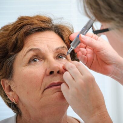 Blepharo Microexfoliation (Bleph-Ex)