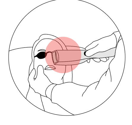 Intense Pulse Light – Eye-Light Optimal Power Energy Technology - Espansione™ Group